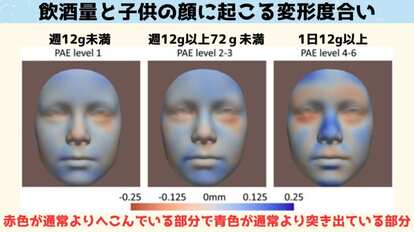飲酒量と子供の顔への影響