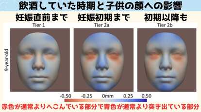 飲酒時期と子供の顔への影響