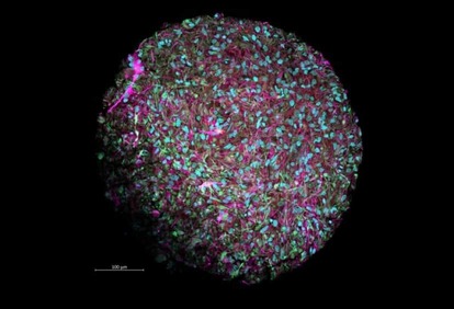 未来のコンピューターの原動力は人間の脳細胞になるかもしれない