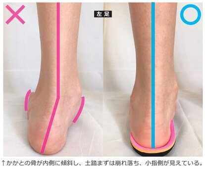 インソール使用の様子