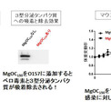 腸管出血性大腸菌O157の無毒化に群馬大などが成功