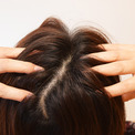 加齢による薄毛と普通の薄毛の原因と予防法は違う？