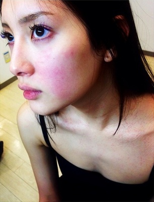 菜々緒が 謎の湿疹 を公開 ファンからは心配の声 ニコニコニュース 菜々緒が 謎の湿疹 を公開 ファンからは心配の声 ニコニコニュース