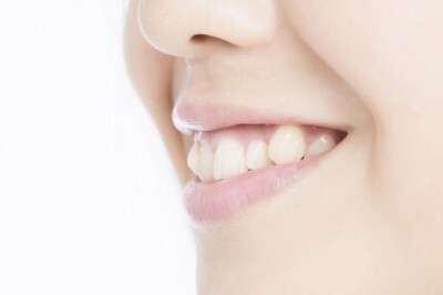 男子のホンネ 八重歯はかわいい 男子が感じる歯並びの印象4つ ニコニコニュース 男子のホンネ 八重歯はかわいい 男子が感じる歯並びの印象4つ ニコニコニュース