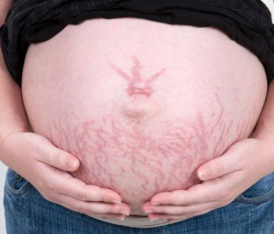妊娠線 を見たとき 夫が妻に冷める瞬間7 授乳のためにどこでも乳を ニコニコニュース