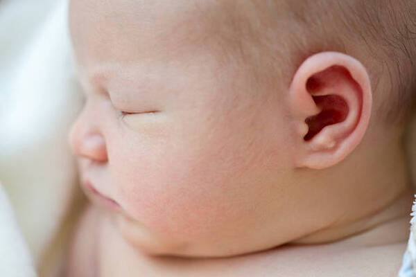 医師監修 赤ちゃんでも発症する中耳炎 その原因と治療方法 ニコニコニュース