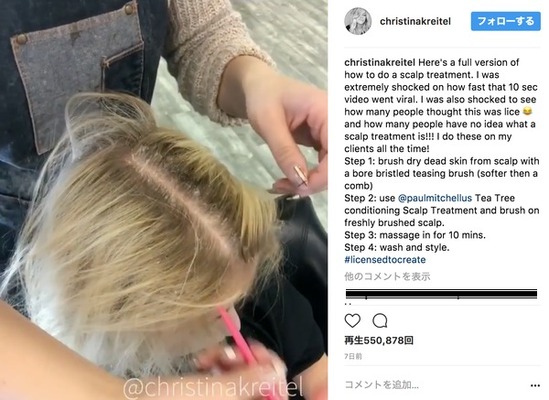 頭皮の フケ をひたすら剥がす動画 中毒性ヤバイ と330万回再生 気持ち悪いけど妙な達成感 ニコニコニュース