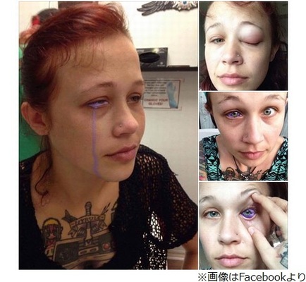 目にタトゥー が失敗 紫色の涙流し後悔 ニコニコニュース