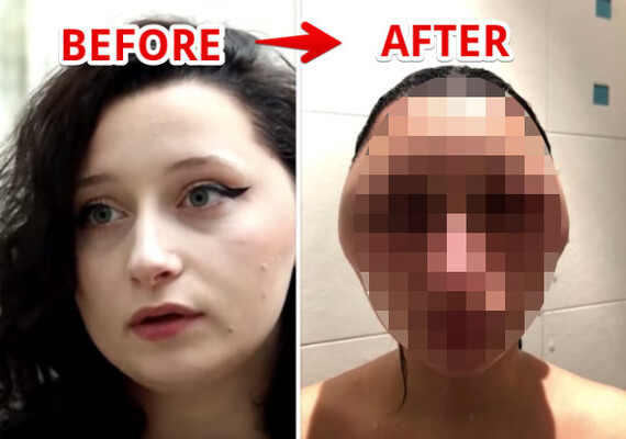 朝起きたら異星人 自宅でのヘアカラーはパッチテストを十分に行わないと大変なことになる件 ニコニコニュース