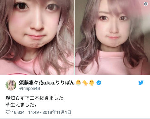 キュートなハム太郎系女子 親知らずを抜いてぷっくりしちゃった女子たちを一挙に ニコニコニュース キュートなハム太郎系女子 親知らずを抜いてぷっくりしちゃった女子たちを一挙に ニコニコニュース