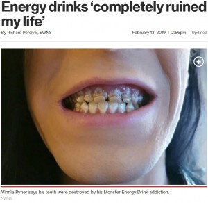モンスターエナジーを飲み過ぎた男性 全ての歯がボロボロに 歯科医 これまで診た中で最も酷い 英 ニコニコニュース