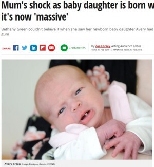 3 000人に1人 前歯が生えた状態で生まれた赤ちゃん 英 ニコニコニュース 3 000人に1人 前歯が生えた状態で生まれた赤ちゃん 英 ニコニコニュース