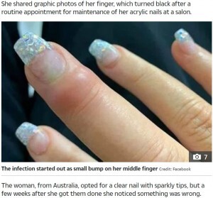 ネイルサロンで道具が殺菌されている確証ない クリアネイルで重度の感染症に 豪 ニコニコニュース ネイルサロンで道具が殺菌されている確証ない クリアネイルで重度の感染症に 豪 ニコニコニュース