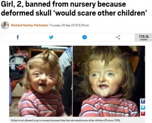 他の子が怖がる 頭蓋骨変形の2歳女児の入園を保育園が拒否 露 ニコニコニュース 他の子が怖がる 頭蓋骨変形の2歳女児の入園を保育園が拒否 露 ニコニコニュース