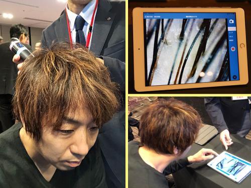 39歳のオッサンがアデランスの新cm発表会で無料ヘアチェックを体験してきた話 ニコニコニュース 39歳のオッサンがアデランスの新cm発表会で無料ヘアチェックを体験してきた話 ニコニコニュース