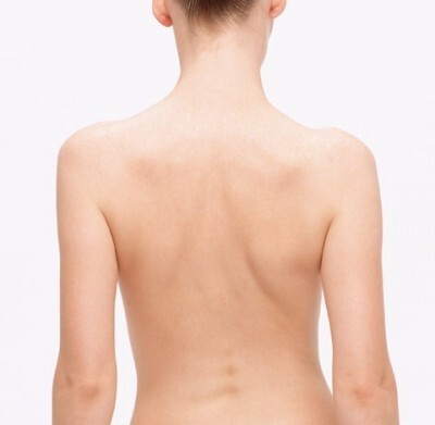 いつまでも治らない背中ニキビ それ ニキビじゃなくてカビかも ニコニコニュース