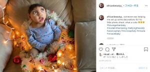 脳がはみ出た状態で産まれた男児が1歳4か月に 母親は 絶対に生き抜く 米 ニコニコニュース 脳がはみ出た状態で産まれた男児が1歳4か月に 母親は 絶対に生き抜く 米 ニコニコニュース