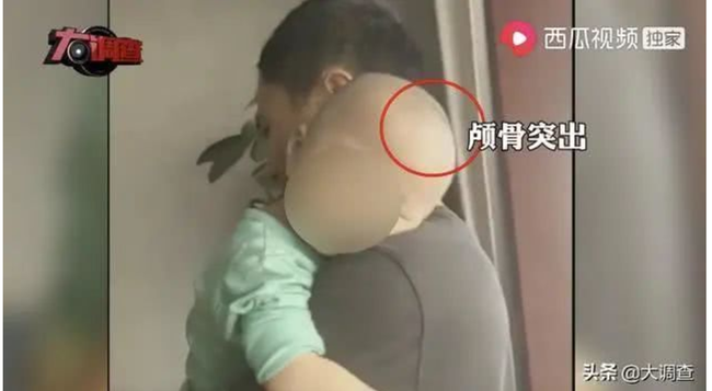 中国で偽粉ミルクが続出 飲んだ乳幼児の頭が大きくなる被害 ニコニコニュース