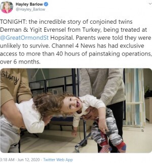 頭蓋結合双生児 イギリスでの分離手術から5か月で帰国 もうすぐ2歳に トルコ 動画あり ニコニコニュース