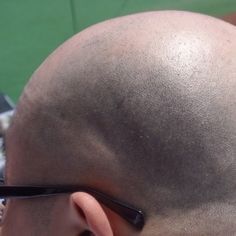 意外な薄毛の原因 坊主頭をボディーソープで洗うのはng ニコニコニュース