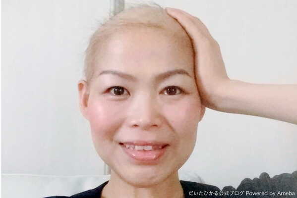 乳がん発覚から5年のだいたひかる 当時の写真を公開 本当に可愛い と感動の声 ニコニコニュース 乳がん発覚から5年のだいたひかる 当時の写真を公開 本当に可愛い と感動の声 ニコニコニュース